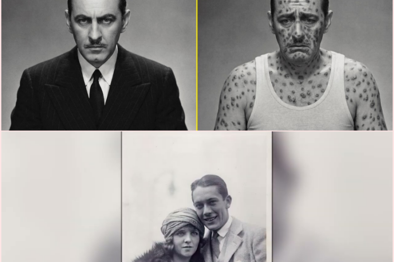 10 Classic Hollywood Legends Who Went Insane from Untreated Syphilis ht