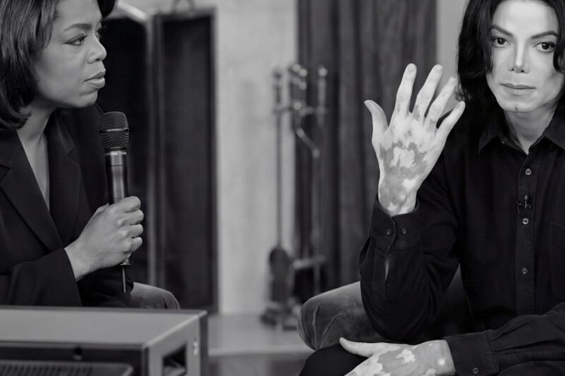 Michael Jackson Showed Oprah His Vitiligo in Live Interview —90M Viewers Were Glued to Their Screens D