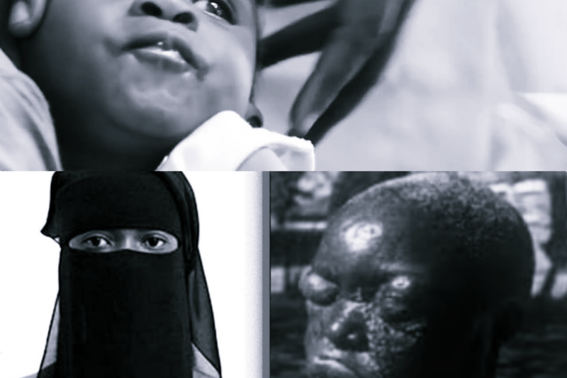 The HORRIFYING History of Ebola JJ