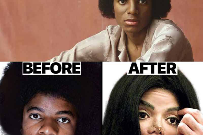 The Heartbreaking Medical Truth Behind Michael Jackson’s Face That Will Make You Cry