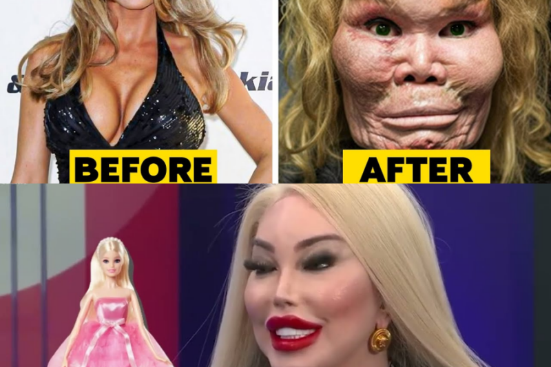 20 Celebrity Plastic Surgery Disasters – Ty
