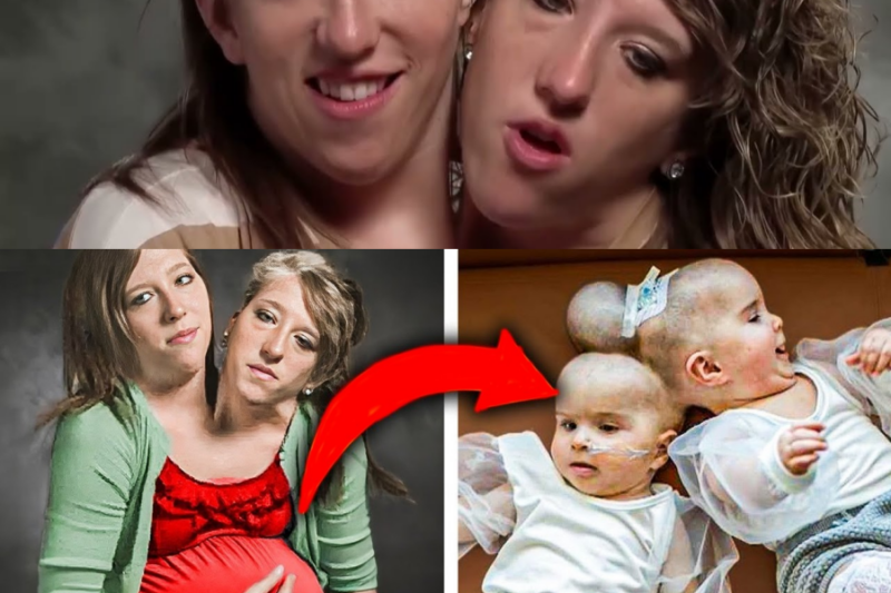 Mother Of The Conjoined Twins Confirmed The Horrible Rumors Are True