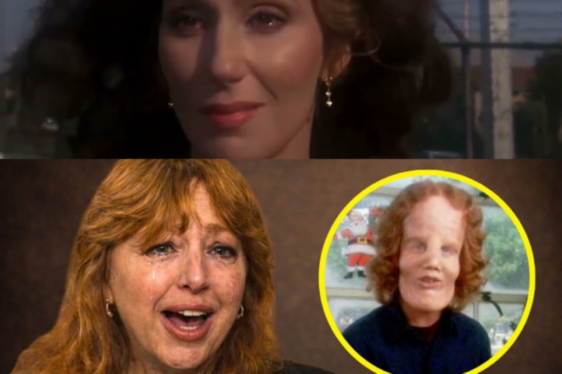 Before She Died, Rocky Dennis’s Mom FINALLY Broke Silence About Rocky Dennis And It’s BAD