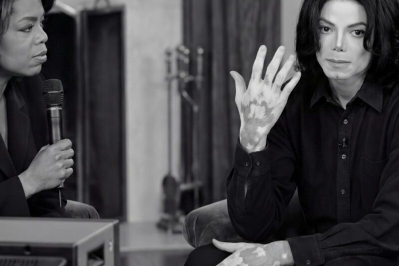 Michael Jackson Showed Oprah His Vitiligo in Live Interview —90M Viewers Were Glued to Their Screens
