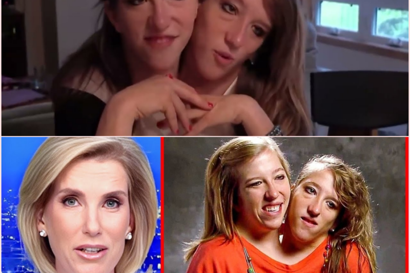 Did You Hear What Happened To The Conjoined Twins? 