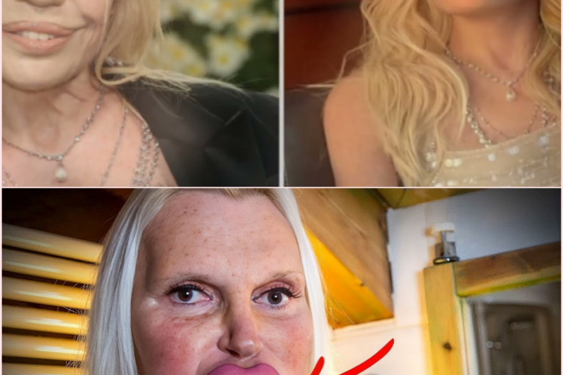 15 disastrously failed cosmetic surgeries | Before and After 2026 