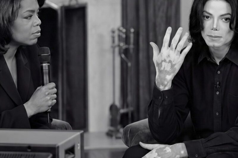 Michael Jackson Showed Oprah His Vitiligo in Live Interview —90M Viewers Were Glued to Their Screens D