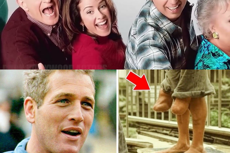 20 Hollywood Stars With Shockingly Weird Body Features You Missed 